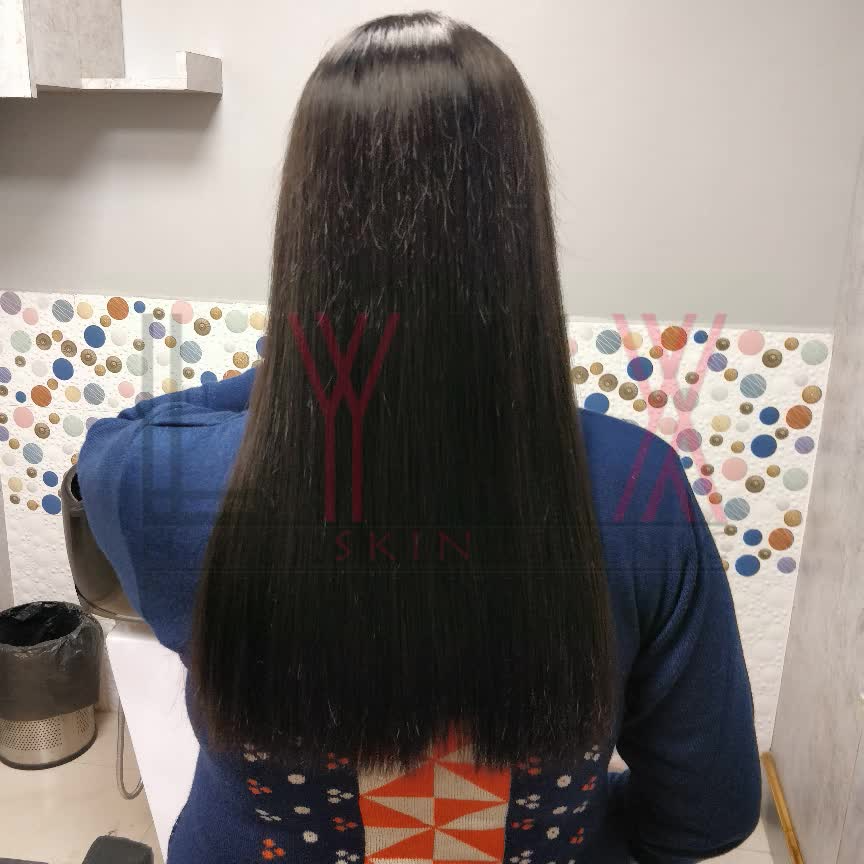 Prem Hair Expert LYNX Jaipur Wigs for Cancer patients in Jaipur