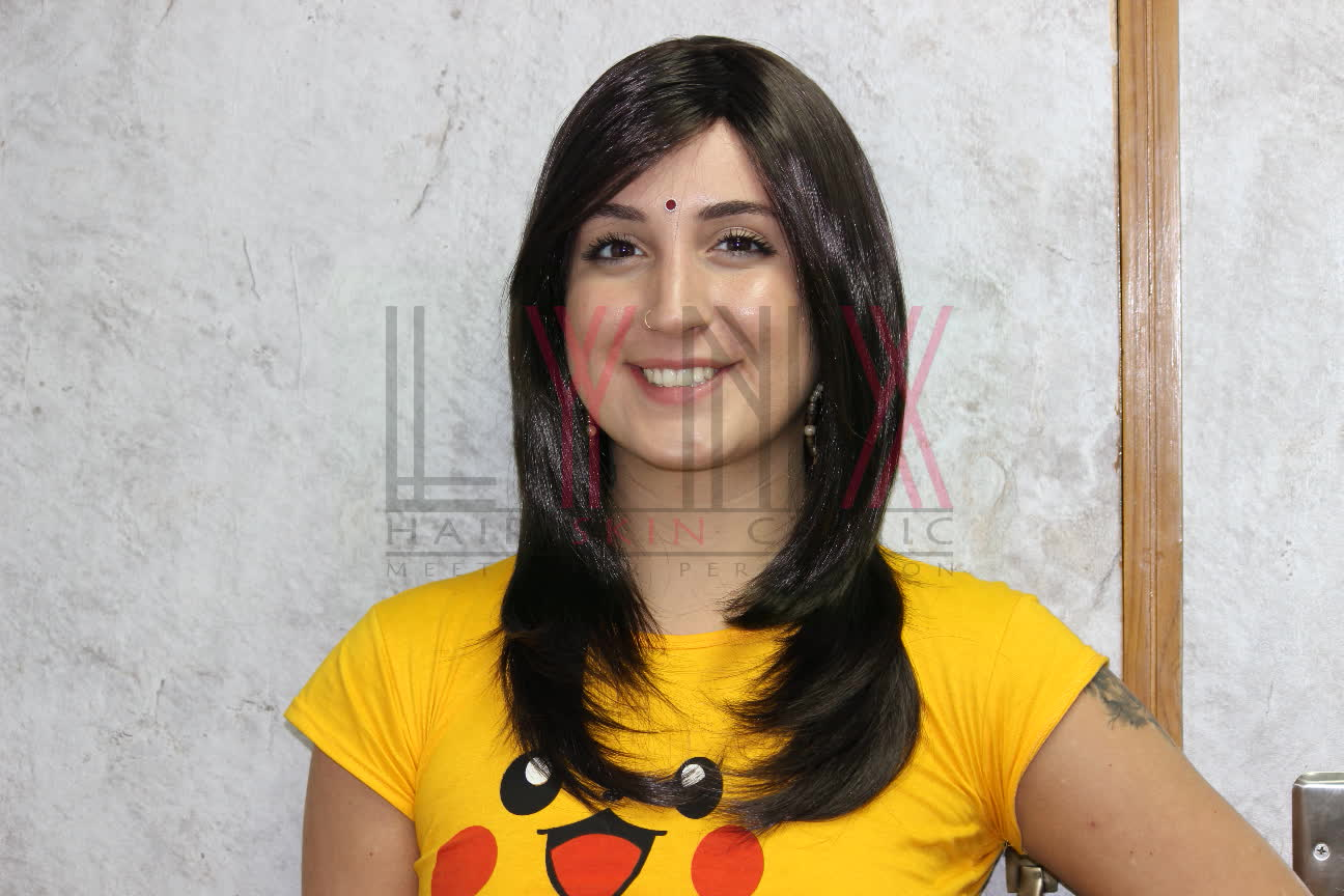 Prem Hair Expert LYNX Delhi Hair Wigs in Naraina Delhi